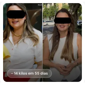 Resultado antes e depois de paciente (rosto preservado): -14 kg em 55 dias