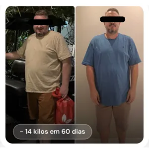 Resultado antes e depois de paciente (rosto preservado): -14 kg em 60 dias