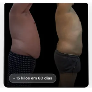 Resultado antes e depois de paciente (rosto preservado): -15 kg em 60 dias