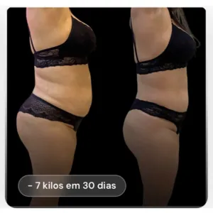 Resultado antes e depois de paciente (rosto preservado): -7 kg em 30 dias